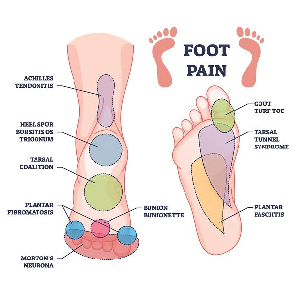 8 Ways to Relieve Foot Pain